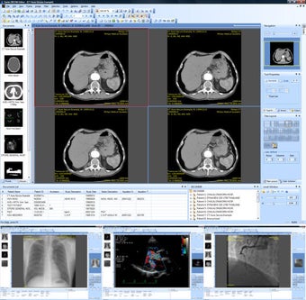 Imagen 0 para Sante DICOM Viewer PRO