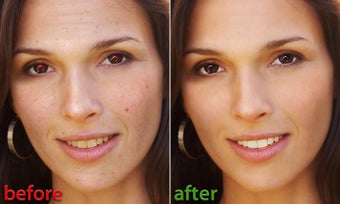 Imagen 2 para Visage Lab - face retouch