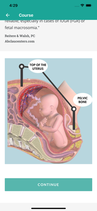Image 2 for WCEA