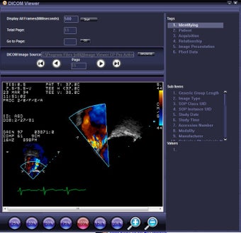 Image 0 for DICOM Viewer