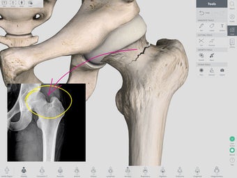 Image 1 for Complete Anatomy 2018