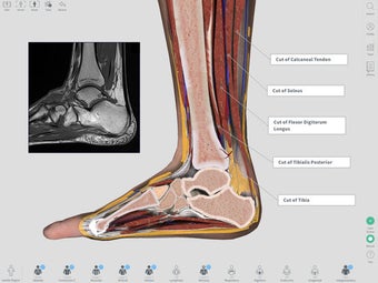 Image 0 for Complete Anatomy 2018