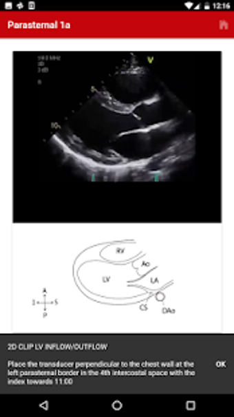Imagen 3 para Echo UW