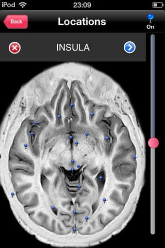 Image 0 for iRad Brain MRI PRO