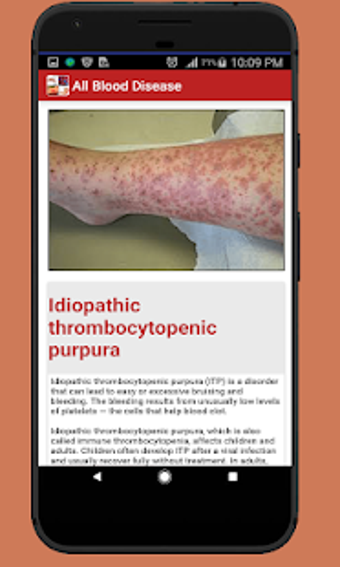 Image 1 for All Blood Disease and Tre…
