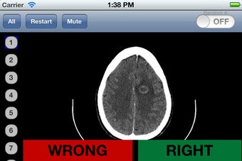 Image 7 for Neuroradiology Flashcards