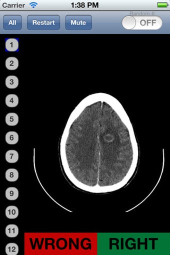 Image 5 for Neuroradiology Flashcards