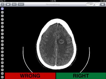 Image 4 for Neuroradiology Flashcards
