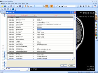 Image 1 for MicroDicom Viewer Portabl…