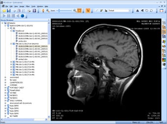 Imagen 1 para MicroDicom Viewer Portabl…