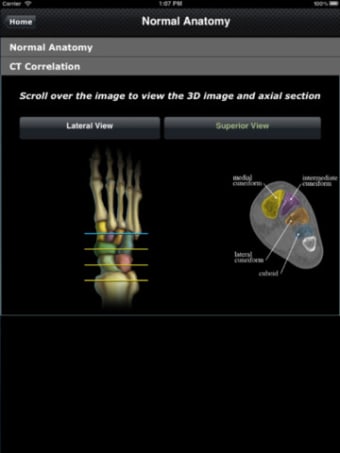 Image 3 for CTisus: CT of the Foot
