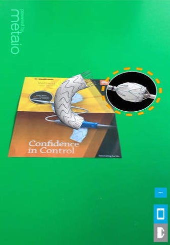 Image 0 for MDT Aortic AR