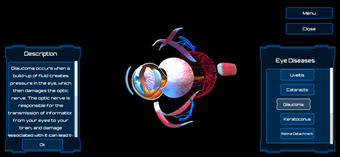 Image 2 for Anatomy Human Eye