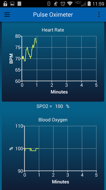 Imagen 2 para Pulse Oximeter