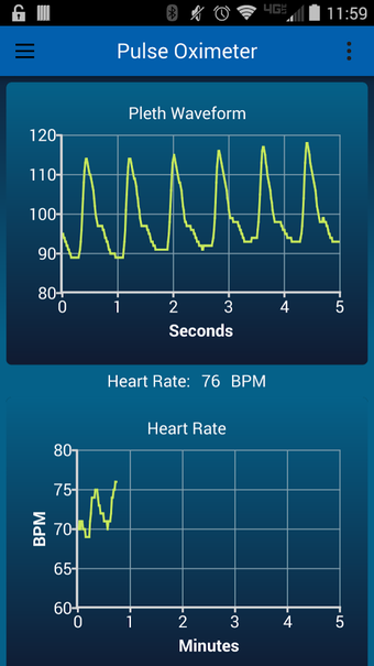 Imagen 3 para Pulse Oximeter