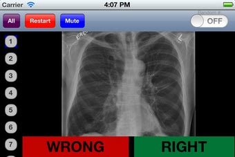 Imagen 1 para Chest Radiology Flashcard…
