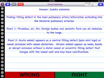 Imagen 2 para Chest Radiology Flashcard…