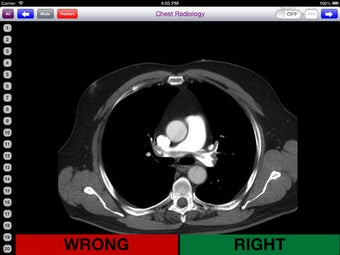 Imagen 5 para Chest Radiology Flashcard…