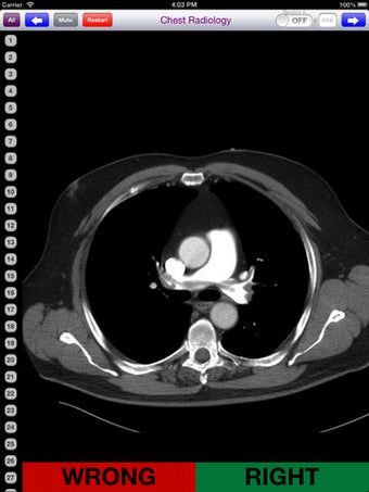 Imagen 4 para Chest Radiology Flashcard…