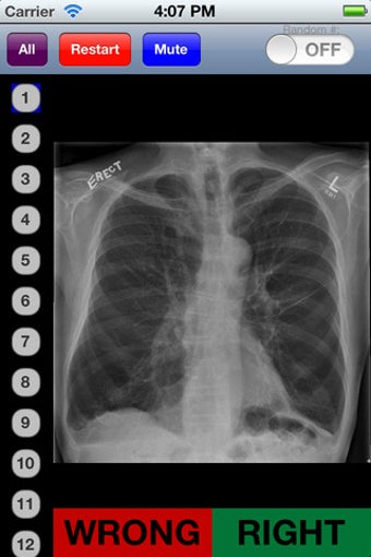 Imagen 3 para Chest Radiology Flashcard…