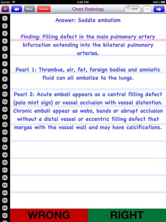 Imagen 0 para Chest Radiology Flashcard…