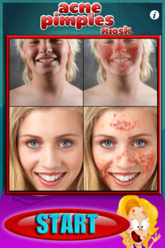Image 0 for Acne Pimples Kiosk  HD Li…