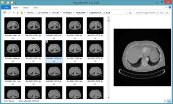 Image 0 for DICOm Thumbnailer