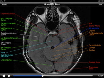 Imagen 0 para Brain MRI Atlas