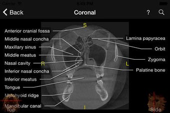 Image 0 for CBCT