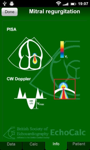 Image 1 for EchoCalc