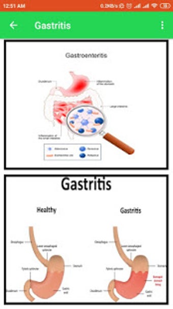Imagen 2 para Medical Surgical Nursing