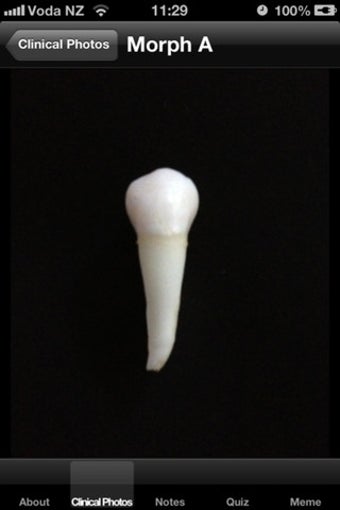 Image 0 for Tooth Morphology Exam pre…