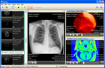 Imagen 0 para Ginkgo CADx