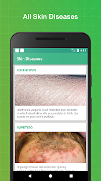 Imagen 1 para All Skin Diseases and Tre…