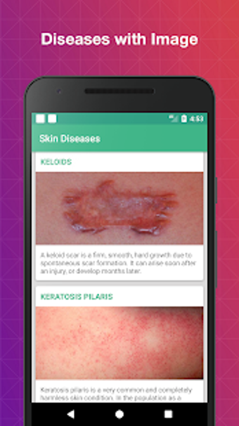 Imagen 3 para All Skin Diseases and Tre…