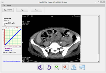 Imagen 0 para Free DICOM Viewer