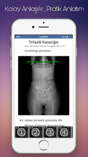 Image 3 for Radiology Master (Tomogra…