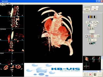 Image 0 for KB-Vol3D