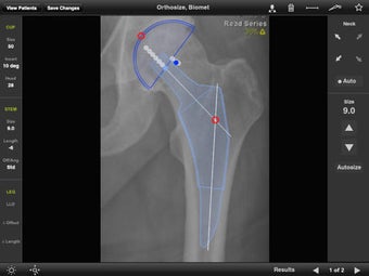Image 0 for Biomet Orthosize Templati…