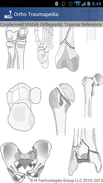 Image 0 for Ortho Traumapedia