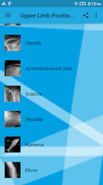 Image 3 for Upper Limb Radiographic P…