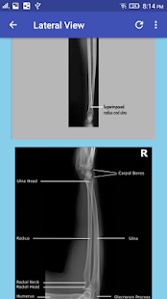 Image 0 for Upper Limb Radiographic P…