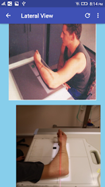 Image 1 for Upper Limb Radiographic P…
