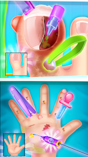 Imagen 0 para Pinky toe doctor