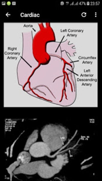Imagen 3 para Atlas of CT Anatomy