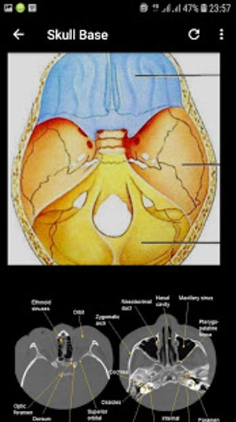 Imagen 1 para Atlas of CT Anatomy