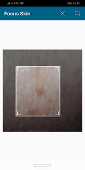Image 3 for Smart Skin Cancer Detecti…