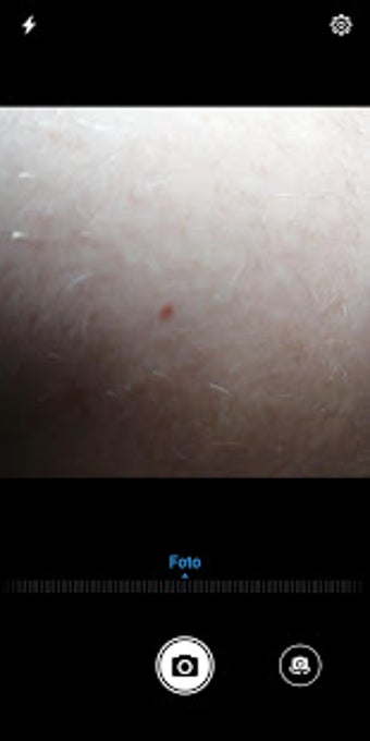 Image 0 for Smart Skin Cancer Detecti…