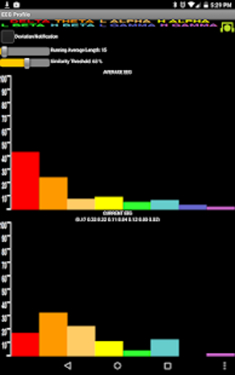 Image 1 for EEG Profile