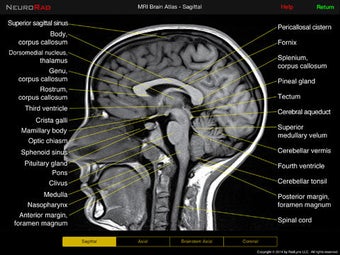 Image 0 for NeuroRad